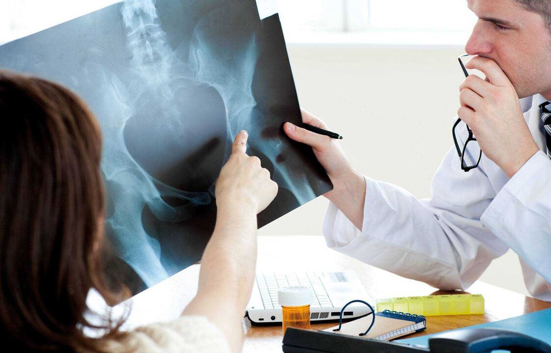 medikuek erradiografia aztertzen duten aldakako artrosia